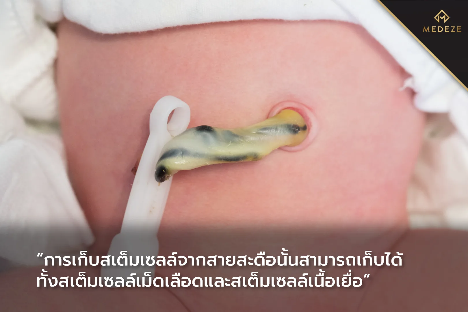 เยื่อสายสะดือ