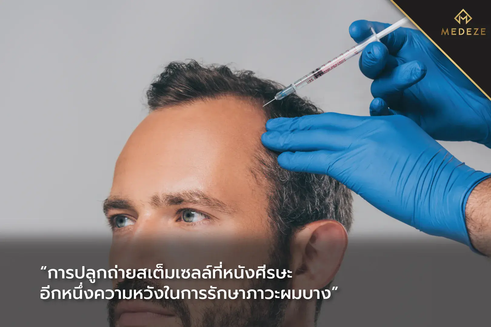 สเต็มเซลล์