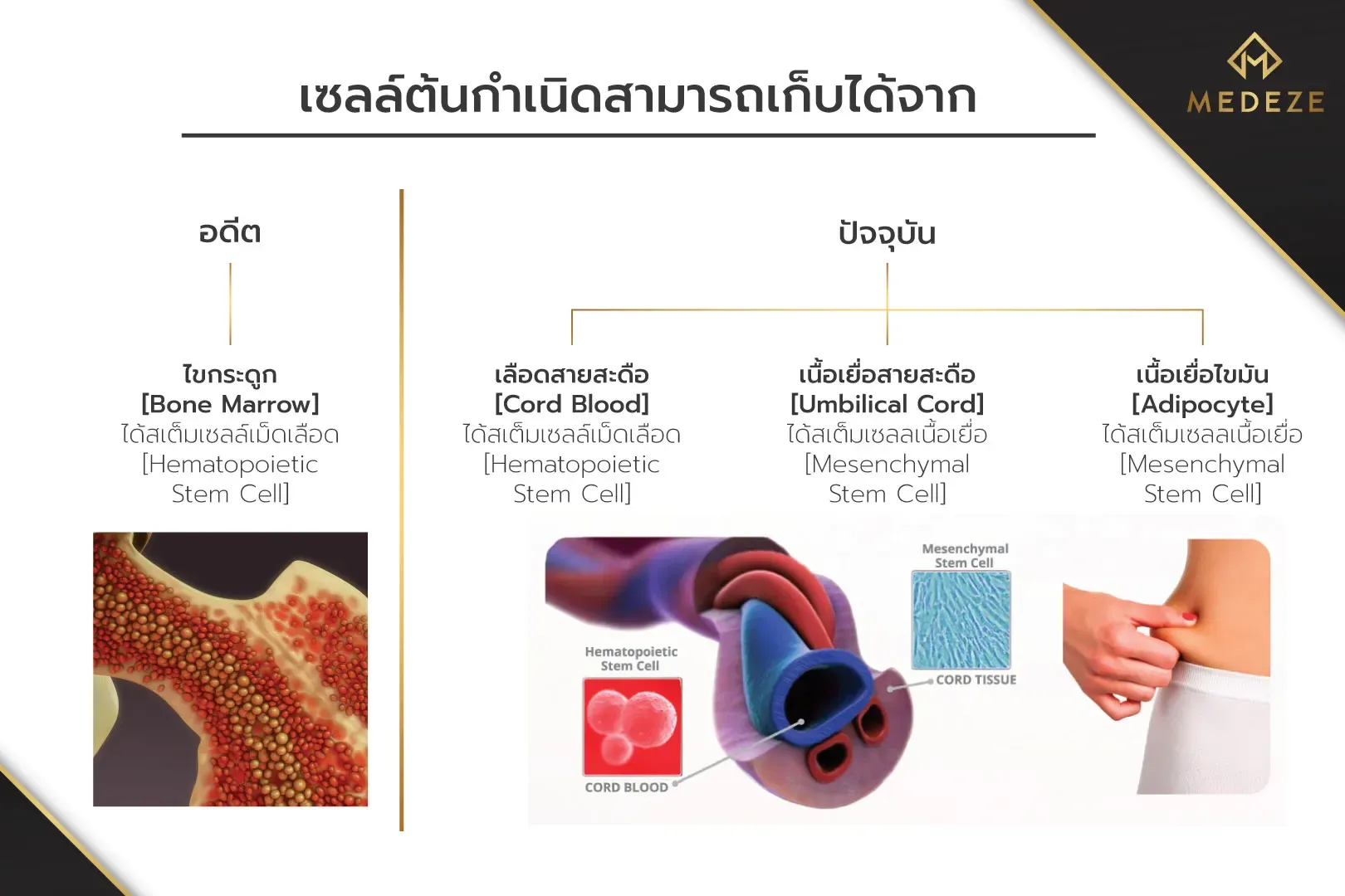 สเต็มเซลล์เก็บจากไหนได้บ้าง