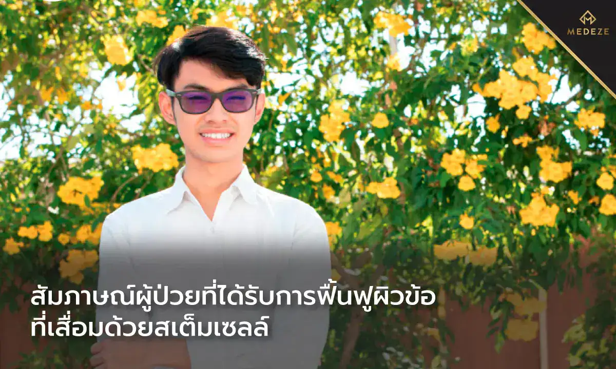 สัมภาษณ์ผู้ป่วยที่ได้รับการฟื้นฟูผิวข้อที่เสื่อมด้วยสเต็มเซลล์
