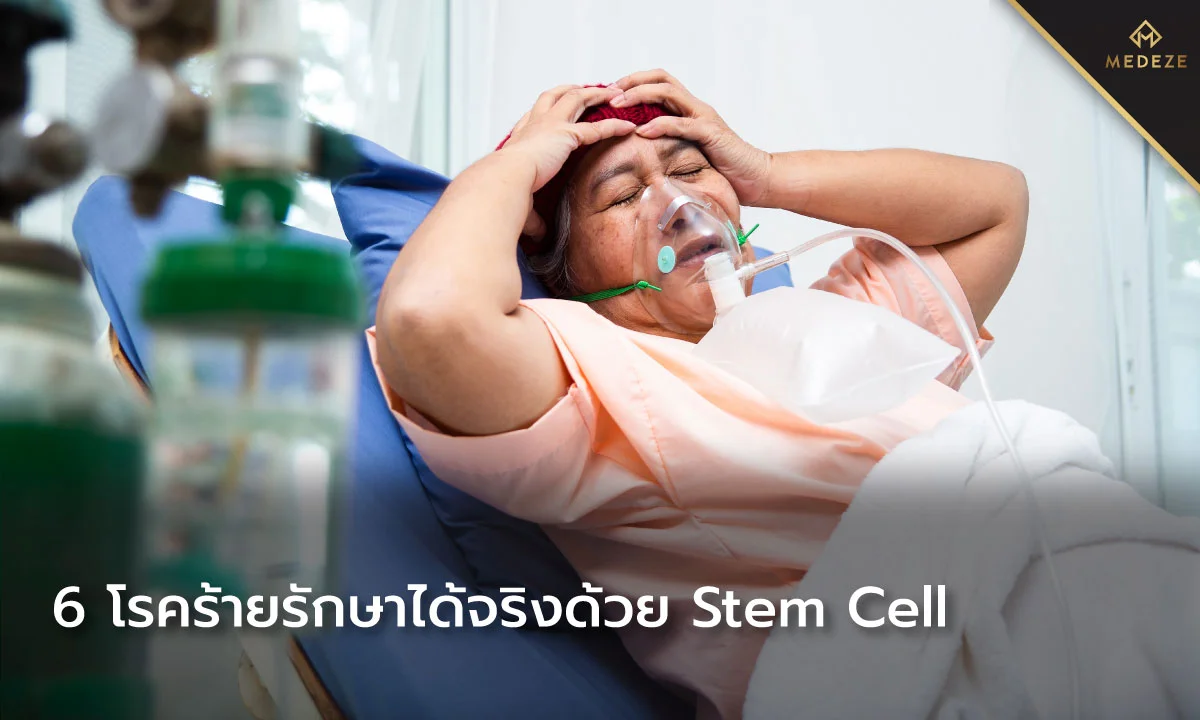สเต็มเซลล์ รักษา 6 โรค ฟื้นฟูร่างกาย